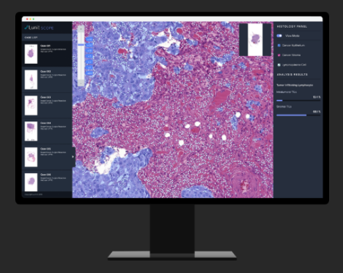 암 환자의 치료반응을 예측하는 AI조직 분석 플랫폼 Lunit SCOPE 도입